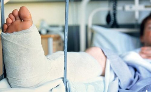 Производственная травма в пос. Чкалова в Запорожье - мужчине зажало ногу поддоном